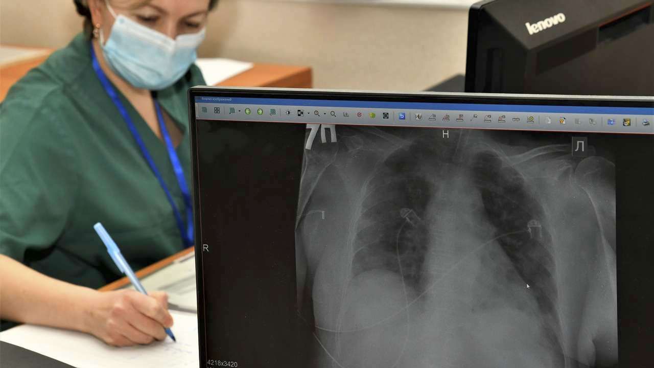 10 лет положительной динамики. В Прикамье снижается заболеваемость туберкулезом 