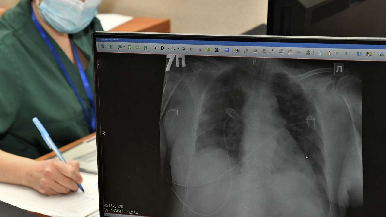 В Прикамье отмечен рост профессиональной заболеваемости