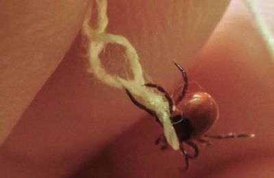 В Прикамье клещи укусили восемь человек